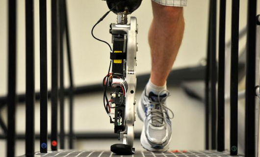 哪些因素會(huì)影響到人們穿戴河南假肢(圖1) 哪些因素會(huì)影響到人們穿戴河南假肢(圖1)