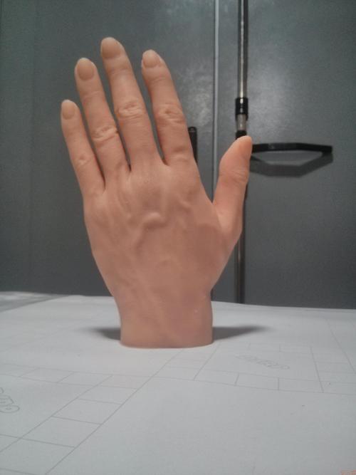 假肢廠(chǎng)家安裝手指假肢時(shí)要注意哪些問(wèn)題(圖1)