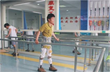 假肢穿戴時間和假肢價格有關系嗎(圖1) 假肢穿戴時間和假肢價格有關系嗎(圖1)