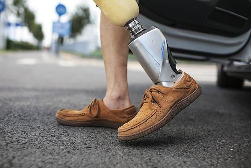 安裝一個假肢大概需要多少錢鄭州力康假肢廠家(圖1) 安裝一個假肢大概需要多少錢鄭州力康假肢廠家(圖1)